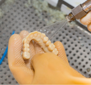 Dental Technicians Cleans 3d Printed Dental Implant Bridge